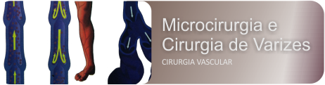 Microcirurgia e Cirurgia de Varizes